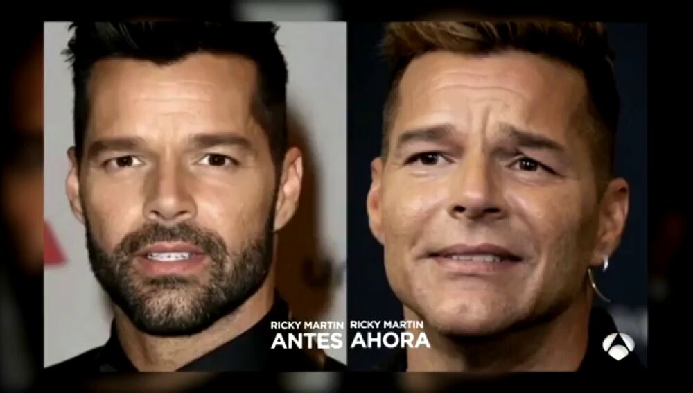 La explicación oficial de Ricky Martin a todas las personas preocupadas por su "nueva imagen"