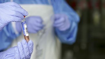 Muestra de coronavirus de un laboratorio Muestra de coronavirus de un laboratorio